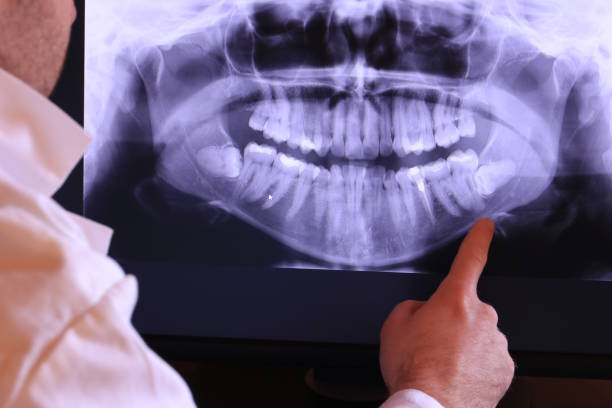 Best Emergency Denture Repair in Lucasville, OH