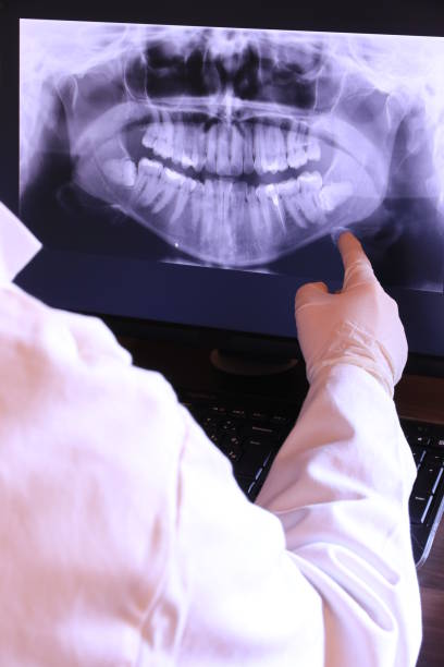 Best Emergency Dental Care for Broken or Chipped Teeth in Lucasville, OH